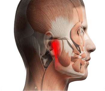 DISFUNÇÃO TEMPOROMANDIBULAR dtm