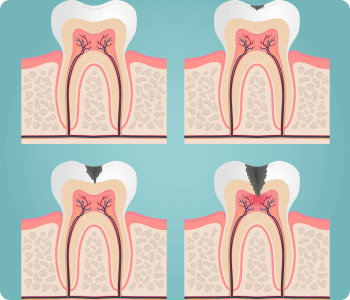 Endodontia Endodontia