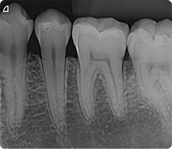 radiografia radiografia